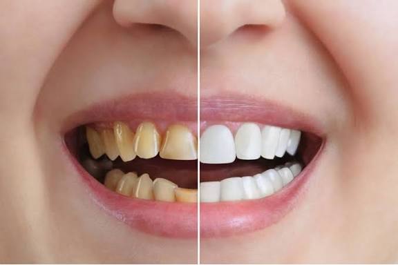 Dental slide 2